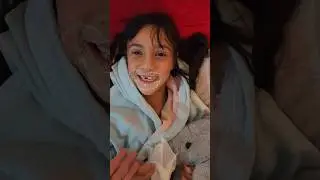 Umay'ın Yüzüne Ne Oldu #shortsvideo #shorts