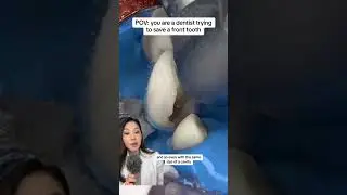 Trying to save a front 🦷 tooth with a large cavity. 