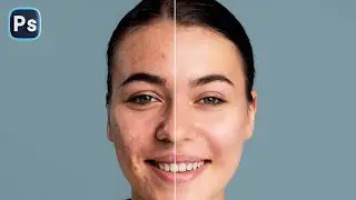Skin Retouching - Best Photoshop Tutorial | Skin Retouching 