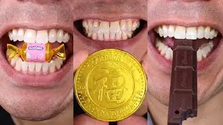 The Most Addictive Chocolate and Candy Chewing ASMR Sounds Ever Doctor Tristan Peh