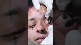 Tatuagem no olho 