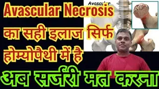 How can we manage Avascular Necrosis with Homeopathic medicines without surgery