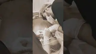 Пересадка бороды по уникальной безоперационной методике HFE