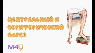 Центральный и периферический паралич