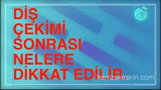 Diş Çekimi Sonrası Dikkat Edilmesi Gereken 10 Kural