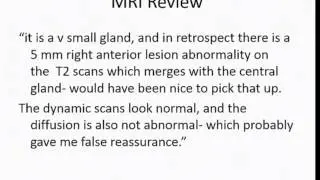 Prostate Cancer Case discussion