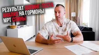 Результат ДОПИНГ-ТЕСТА. Анализ крови на ГОРМОНЫ. Что по грыжам? МРТ спины.