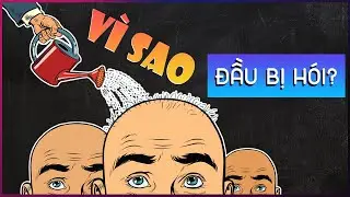 Vì sao ta lại bị hói đầu? Các phương pháp cải thiện tình trạng này