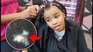 My 10 Year Old Daughter Has A BALD Spot And Blamed ME!