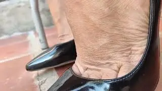 My Feet Are Itching