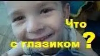 Что с нашим глазом? Халязион что это такое?