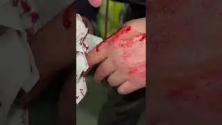 СРОЧНО!АРТЕМ ИЗБИЛИ!  | Паша Пэл