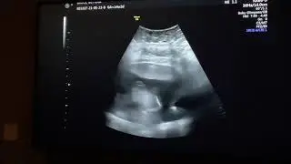 Waylon 5/23 pt 2