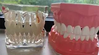 A day in my life as a general dentist - highlight reel
