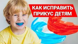 Исправление прикуса у детей с помощью трейнера