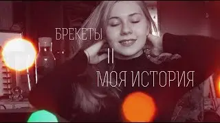 БРЕКЕТЫ  || МОЯ ИСТОРИЯ || ВАЛЕРИЯ МАКСИМОВА