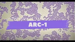 Густая кровь, что делать ? ARC-1 