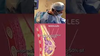 Fat Transfer To Breast 