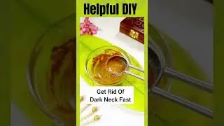 Helpful DIY: Get Rid Of Dark Neck Under 15 Mins!
