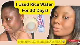 I Tested Rice Water On My Face For 30 Days Straight. This Is What Happened Afterwards!😳