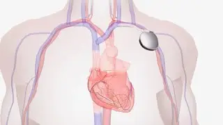 PrepMD CEU-Accredited Online Training For Device Clinics