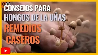 COMO quitar HONGO de las UÑAS con remedio casero | FACIL y efectivo