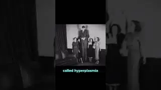 The Tallest Person Ever To Lived!😨 #shorts