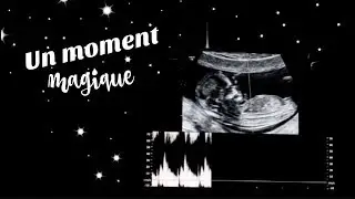 ECHO DES 12sa - JE SAIS SI C'EST UNE FILLE OU UN GARÇON ♡