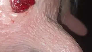 Папилломы у коровы.
