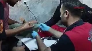 Parmağına plastik parçası sıkışan çocuğu itfaiye kurtardı