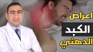 اعراض الكبد الدهني | علامات غريبه تدل علي الاصابه بالكبد الدهني