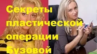 Секреты пластической операции Ольги Бузовой с ДОМа-2