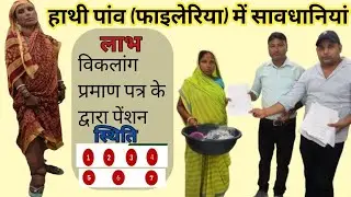 Treatment for Hathi Paw. How will Hathi Paw be cured? Hathi Paw disease. Filariasis disease. Symp...