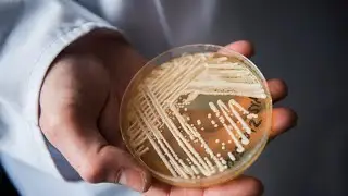 The Unseen Threat: Candida Auris