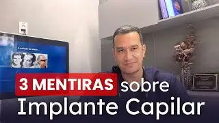 3 maiores MENTIRAS sobre IMPLANTE CAPILAR e calvície