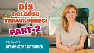 Diş Dolgusu Hakkında Merak Ettiğiniz Her Şey Bu Videoda!