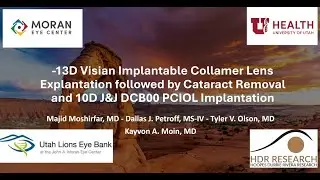 Visian ICL Explantation followed by Cataract Removal and PCIOL Implantation