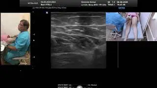 Ultrasound in thrombotic venous obstruction (Professor V.P. Kulikov)