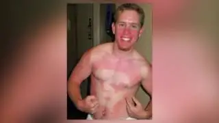 25 Most Embarrassing Tan Line Fails