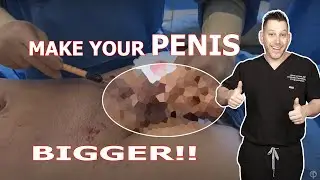 MAKE YOUR PENIS BIGGER WITH YOUR OWN FAT | Dr. Jason Emer