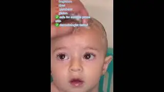 Cradle cap that just won't quit? Turn to clinically tested Happy Cappy.