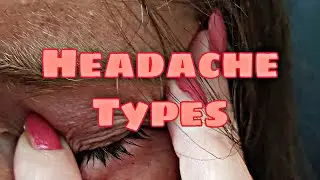 Headache Types|Classification|Knowledge Madnoob