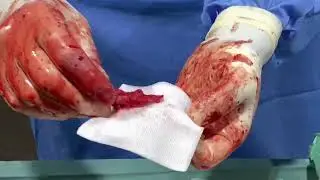 Fagens SURGERY!! There will be blood!
