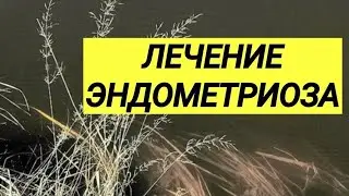 ЛЕЧЕНИЕ ЭНДОМЕТРИОЗА ☝️ Хирургический и альтернативный методы ⚕