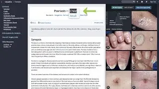 Search for a Diagnosis