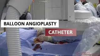 Peripheral Arterial Disease - A glimpse into the Procedure and Treatment