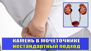 Камень в мочеточнике, лечение без операции Что делать?  