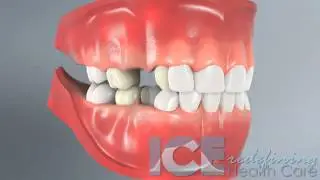 Dental Development (45 Degree Angle View)
