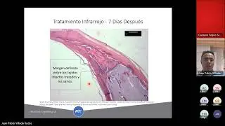 Webinar 68 I Hoja de Ruta para el Tratamiento Infrarrojo de Pico – Claves para el Éxito
