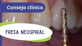 NeoSpiral inteiro spanish